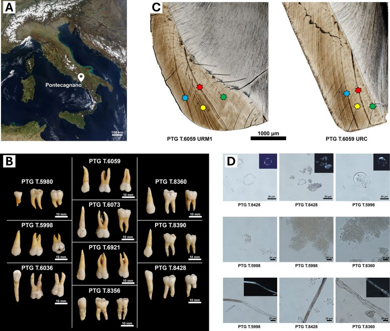 Health and Lifestyle in the Iron Age Italian Community of Pontecagnano